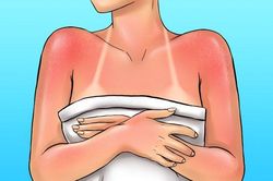 8 mẹo hay giúp bảo vệ làn da của bạn khỏi bị lão hóa nhanh