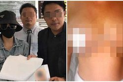 Phẫu thuật thu nhỏ vòng một được vài ngày, cô gái 'khóc thét' vì điều kinh khủng này