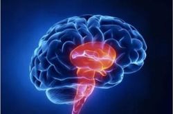 Thói quen trong quan hệ tình dục khiến cô gái 24 tuổi bị nhồi máu não