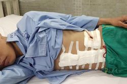 Thanh niên 19 tuổi bị tai nạn vỡ lách cần giúp đỡ