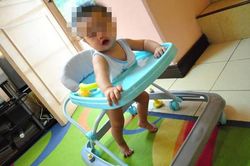 Bé gái 8 tháng tuổi lún sọ não vì ngã xe tập đi