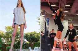 Cô gái mới 16 tuổi đã sở hữu chiều cao khủng, đôi chân dài kỷ lục 1,34m khiến ai cũng phải trầm trồ 'chân dài tới nách' là có thật