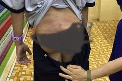 Nghi án bé trai 10 tuổi bị bạo hành khi ở với bố và mẹ kế