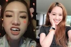 Nhọ như Thúy Vi: Té sấp mặt trong nhà vệ sinh, gãy luôn chiếc răng cửa cả chục triệu