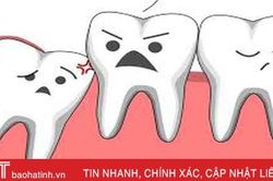 Khi nào nên nhổ răng khôn?