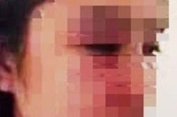Bộ Y tế yêu cầu làm rõ vụ 'bác sĩ bị tố hành hung nữ điều dưỡng'