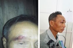 Công an bị 'tố' vào nhà đánh người: Đại úy nói chỉ là 'chuyện gia đình'