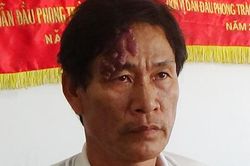 Bắt tạm giam đối tượng giao cấu với người dưới 16 tuổi