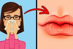 Dấu hiệu trên đôi môi nói lên vấn đề sức khỏe của bạn