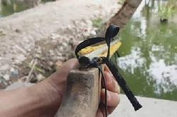 Bé trai 14 tuổi vỡ nhãn cầu, vết thương xuyên sọ bởi súng tự chế