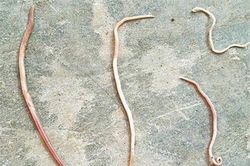 Hãi hùng giun sán bò ra từ... miệng các em nhỏ