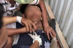Thông tin mới vụ thanh sắt đâm xuyên người khiến công nhân nguy kịch