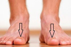 Dấu hiệu từ bàn chân cảnh báo bạn có thể đang mang 'trọng bệnh'