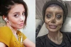 Cô gái 'xác sống' giống Angelina Jolie bị bắt