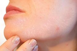 8 dấu hiệu tưởng vô hại nhiều người thường phớt lờ