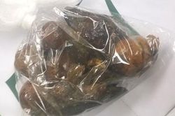 Dạ dày người đàn ông chứa hạt xoài, chanh leo và đồng xu nguyên dạng