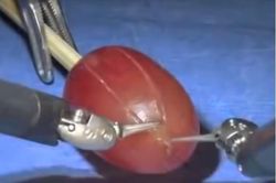 Màn 'phẫu thuật' hoàn hảo đến từng milimet của robot