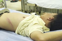 Trưởng văn phòng Thừa phát bị hàng chục đối tượng côn đồ vây đánh hội đồng