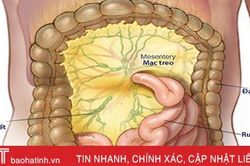 Viêm hạch bạch huyết mạc treo: Bệnh dễ nhầm lẫn