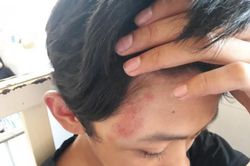 Điều tra vụ nam sinh lớp 9 bị nhóm côn đồ đánh hội đồng