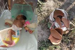 Bị chôn sâu gần 1 mét dưới đất, bé gái sơ sinh gây ngỡ ngàng khi còn sống