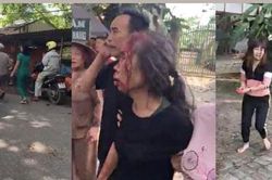 Con rể cũ chém mẹ vợ trọng thương