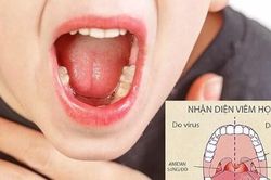 Giao mùa, nếu bố mẹ có thói quen này, con dễ mắc viêm họng và nhiều bệnh nguy hiểm khác