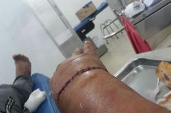 Mâu thuẫn công việc, nam công nhân thủ dao đâm đồng nghiệp