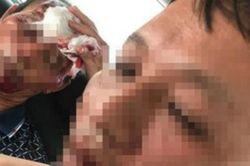 Ba người đang ăn cơm bị nhóm côn đồ nổ súng trọng thương