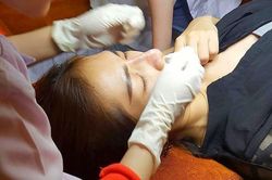 Cảnh báo biến chứng khi làm đẹp bằng phương pháp lột da