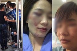 Nữ phụ xe bus Mỹ Đình - Chùa Hương bị 4 thanh niên hành hung trầy mặt
