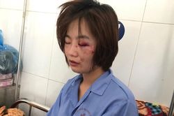 Nữ phụ xe buýt bị 4 thanh niên hành hung: 'Họ vứt lại 1 triệu và bảo đánh thế còn nhẹ'