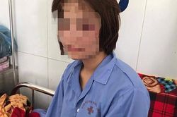 Nữ nhân viên xe buýt bị 4 thanh niên hành hung: 'Đánh tôi xong, 1 người còn nói tao đánh thế là nhẹ'