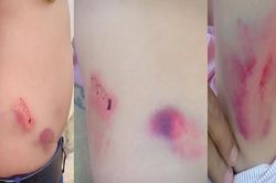 Chánh văn phòng Huyện ủy đánh lái xe cơ quan nhập viện