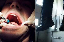 Người đàn ông tự tử vì đau răng khôn mà không được nhổ