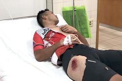 Chấn thương trong thi đấu xe đạp: 'Tử thần' rình rập