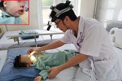 Kinh hoàng bé trai 2 tuổi bị bỏng nặng vì mẹ nhỏ nhầm axit để rửa mũi