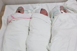 Đỡ đẻ thành công ca sinh ba có cân nặng 7,5kg