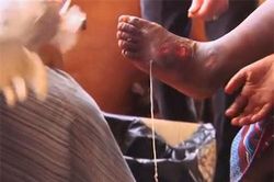 Những thứ kỳ lạ và kinh dị lớn lên trong cơ thể con người