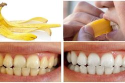 10 cách hô biến hàm răng xỉn màu thành trắng sáng như ngọc