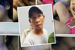 Gã nghiện mất nhân tính hành hạ con riêng của vợ
