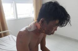 Bị chị gái dội nước sôi lên đầu vì cãi mẹ?