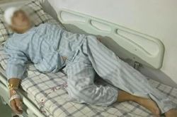 Thường xuyên ăn ốc, người đàn ông bị sán dây 'ăn' não suýt chết
