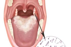 Đà Nẵng: Bệnh viện vất vả 'đi mượn' thuốc điều trị bạch hầu
