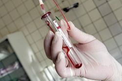 Phát hiện chủng virus HIV mới sau gần 2 thập kỷ