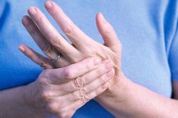 Tê tay chân: Đừng coi thường kẻo không còn thời gian để... 'ân hận'