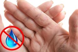 Bất thường ở bàn tay tiết lộ gì về sức khỏe?