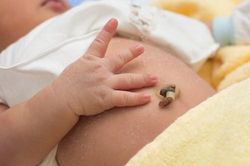 Cách nhận biết dấu hiệu nguy hiểm trên rốn trẻ sơ sinh