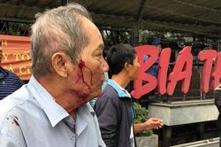Tranh giành 'địa bàn', xe ôm đánh ông cụ 80 tuổi gãy xương sườn gây phẫn nộ