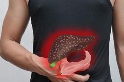 Căn bệnh ung thư có tỷ lệ mắc mới nhiều nhất tại Việt Nam